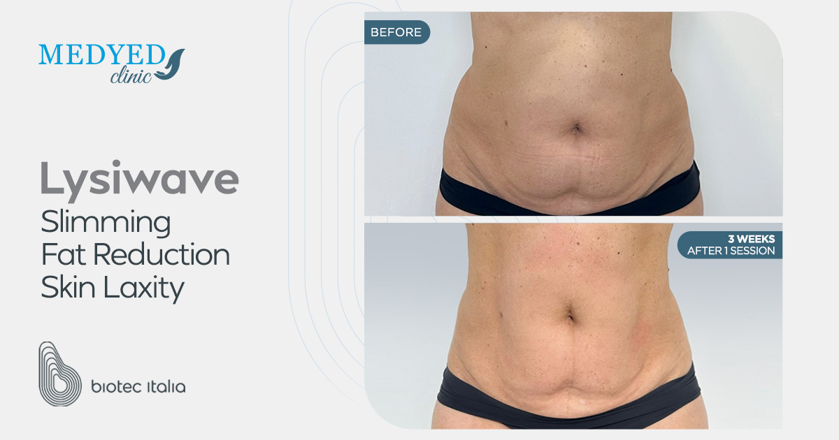 عيادة Medyed تجربة شاملة للعلاجات التجميلية والعافية المتقدمة عيادة Medyed تجربة شاملة للعلاجات التجميلية والعافية المتقدمة
